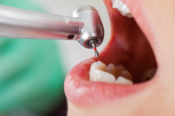 Best Cracked Tooth Emergency Dentist  in Booneville, MS